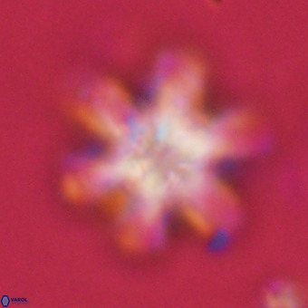 Discoaster sanmiguelensis VR 18544