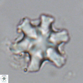 Discoaster sanmiguelensis VR 18546