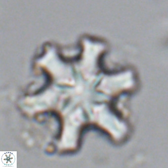 Discoaster sanmiguelensis VR 18547