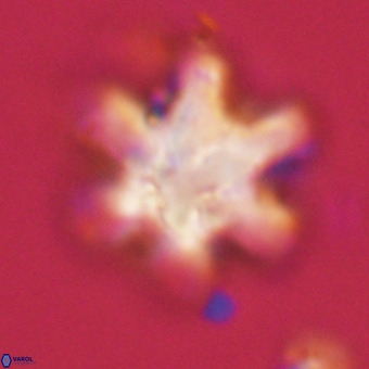 Discoaster sanmiguelensis VR 18541