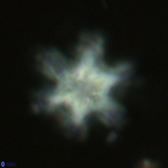 Discoaster sanmiguelensis VR 18542