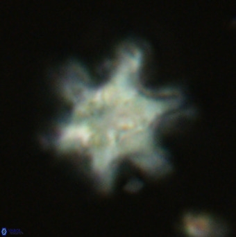 Discoaster sanmiguelensis VR 18543