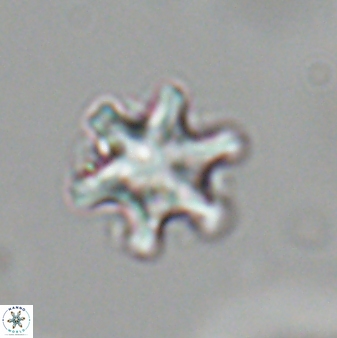Discoaster sanmiguelensis 28509