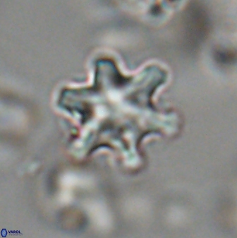 Discoaster sanmiguelensis 28517