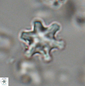 Discoaster sanmiguelensis 28517