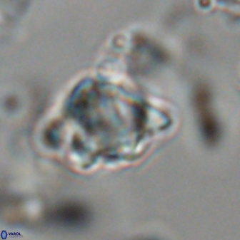 Discoaster sanmiguelensis 28518