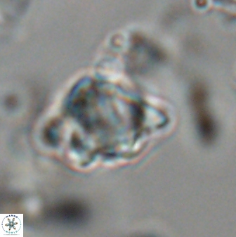 Discoaster sanmiguelensis 28518