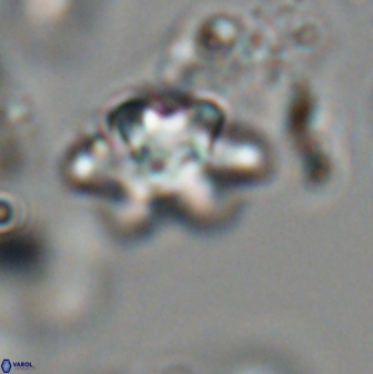 Discoaster sanmiguelensis 28519