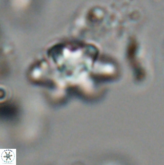 Discoaster sanmiguelensis 28519