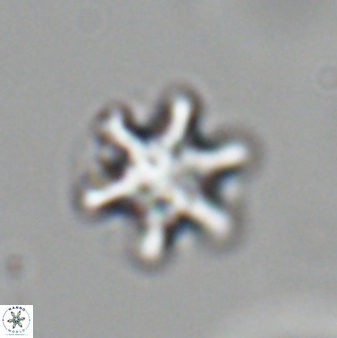 Discoaster sanmiguelensis 28510