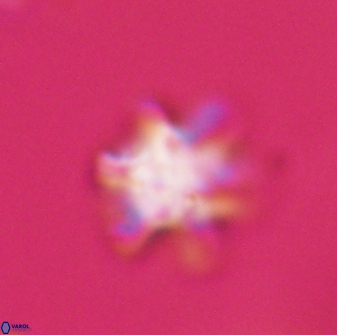 Discoaster sanmiguelensis 28511