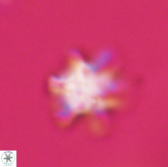 Discoaster sanmiguelensis 28511