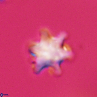 Discoaster sanmiguelensis 28512