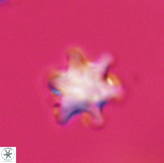 Discoaster sanmiguelensis 28512