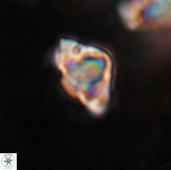Discoaster sanmiguelensis 28524