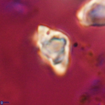 Discoaster sanmiguelensis 28525