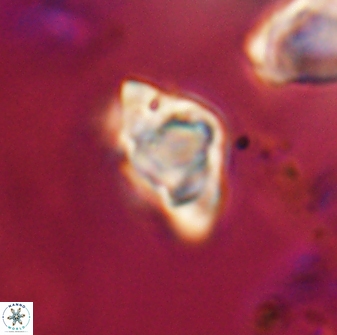 Discoaster sanmiguelensis 28525