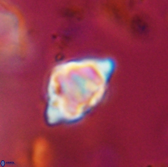 Discoaster sanmiguelensis 28526