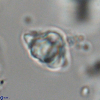 Discoaster sanmiguelensis 28520