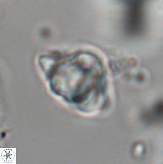 Discoaster sanmiguelensis 28520