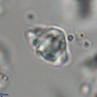 Discoaster sanmiguelensis 28521