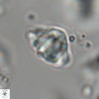 Discoaster sanmiguelensis 28521