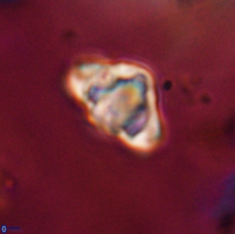 Discoaster sanmiguelensis 28522