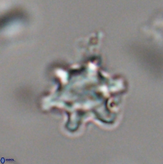 Discoaster sanmiguelensis 28534