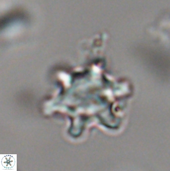Discoaster sanmiguelensis 28534