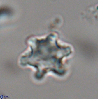 Discoaster sanmiguelensis 28535