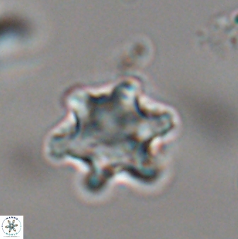 Discoaster sanmiguelensis 28535