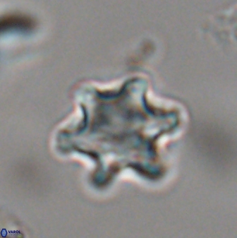 Discoaster sanmiguelensis 28536