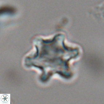 Discoaster sanmiguelensis 28536