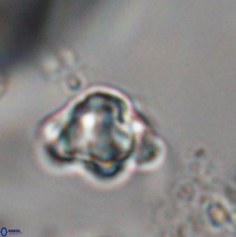 Discoaster sanmiguelensis 28538