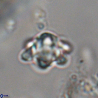 Discoaster sanmiguelensis 28539