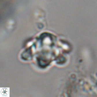 Discoaster sanmiguelensis 28539