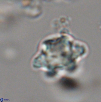 Discoaster sanmiguelensis 28531