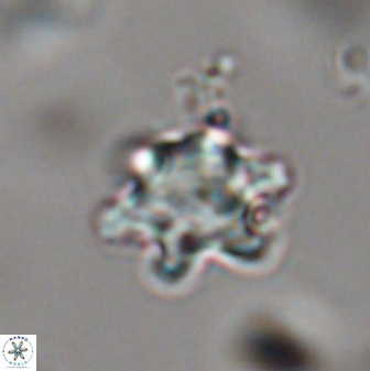 Discoaster sanmiguelensis 28532