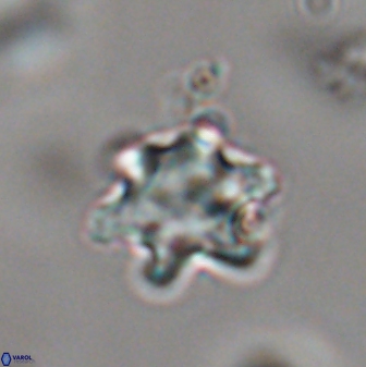 Discoaster sanmiguelensis 28533