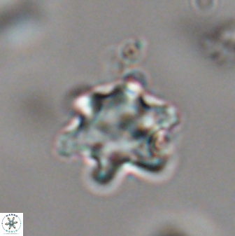 Discoaster sanmiguelensis 28533