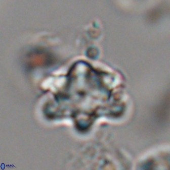 Discoaster sanmiguelensis 28544