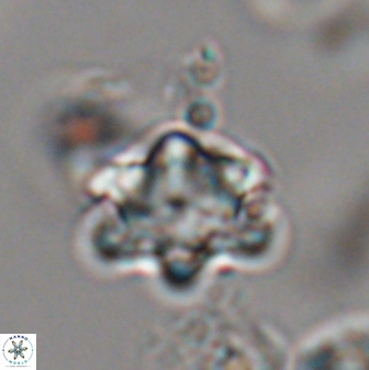 Discoaster sanmiguelensis 28544