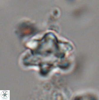 Discoaster sanmiguelensis 28545