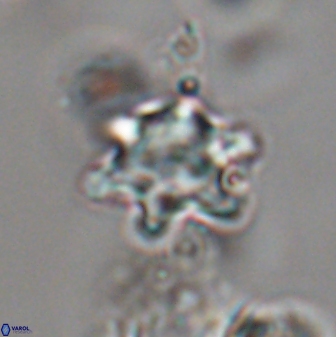 Discoaster sanmiguelensis 28546