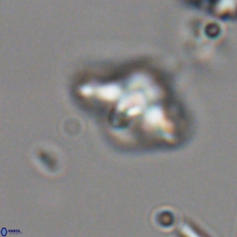 Discoaster sanmiguelensis 28548