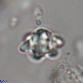 Discoaster sanmiguelensis 28540