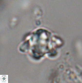 Discoaster sanmiguelensis 28540