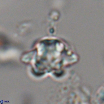 Discoaster sanmiguelensis 28542