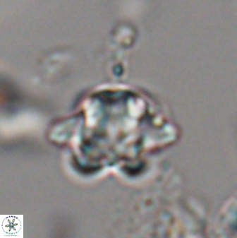 Discoaster sanmiguelensis 28542