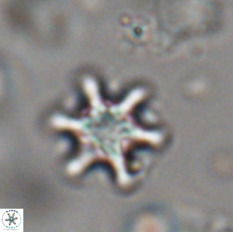 Discoaster sanmiguelensis 28554